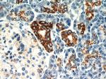 MAOA Antibody in Immunohistochemistry (Paraffin) (IHC (P))