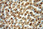 MAOA Antibody in Immunohistochemistry (Paraffin) (IHC (P))