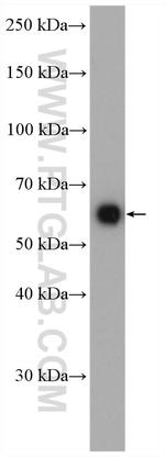 MAOA Antibody in Western Blot (WB)