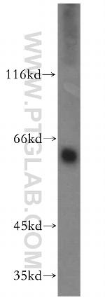MAOA Antibody in Western Blot (WB)