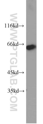 MAOA Antibody in Western Blot (WB)