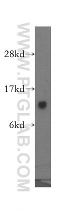 GTF2A2 Antibody in Western Blot (WB)