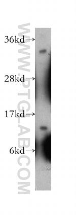 GTF2A2 Antibody in Western Blot (WB)