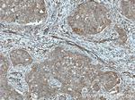 Calmodulin Antibody in Immunohistochemistry (Paraffin) (IHC (P))