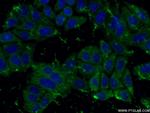 peroxiredoxin 2 Antibody in Immunocytochemistry (ICC/IF)