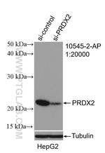 peroxiredoxin 2 Antibody in Western Blot (WB)