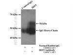 IRF5 Antibody in Immunoprecipitation (IP)