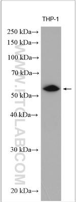 IRF5 Antibody in Western Blot (WB)
