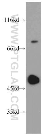 IRF5 Antibody in Western Blot (WB)