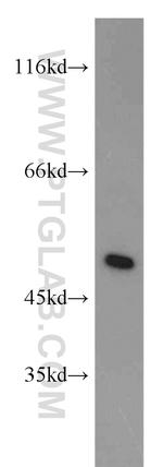 IRF5 Antibody in Western Blot (WB)