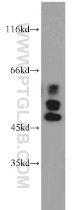 IRF5 Antibody in Western Blot (WB)