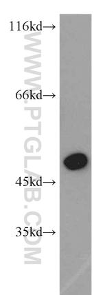 IRF5 Antibody in Western Blot (WB)