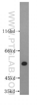 IRF5 Antibody in Western Blot (WB)