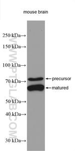 PCSK2 Antibody in Western Blot (WB)