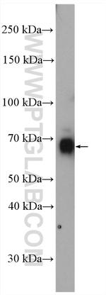PCSK2 Antibody in Western Blot (WB)