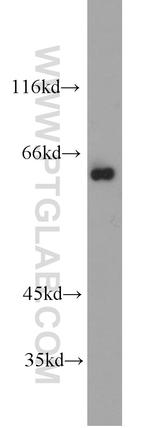 RNPS1 Antibody in Western Blot (WB)