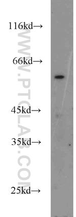 RNPS1 Antibody in Western Blot (WB)