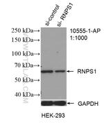 RNPS1 Antibody in Western Blot (WB)