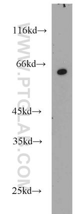 RNPS1 Antibody in Western Blot (WB)