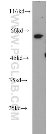 RNPS1 Antibody in Western Blot (WB)