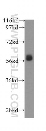 RNPS1 Antibody in Western Blot (WB)