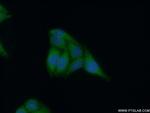 APOL4 Antibody in Immunocytochemistry (ICC/IF)