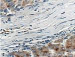 APOL4 Antibody in Immunohistochemistry (Paraffin) (IHC (P))