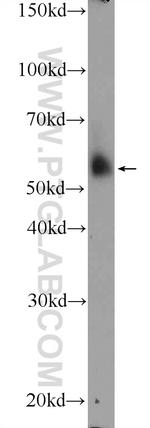 APOL4 Antibody in Western Blot (WB)