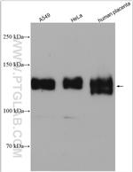 Integrin alpha-5 Antibody in Western Blot (WB)