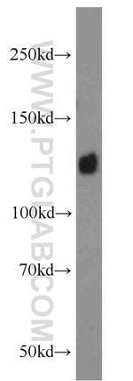 Integrin alpha-5 Antibody in Western Blot (WB)