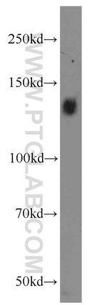 Integrin alpha-5 Antibody in Western Blot (WB)