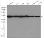CCT3 Antibody in Western Blot (WB)
