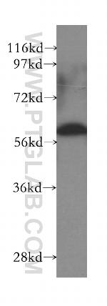 CCT3 Antibody in Western Blot (WB)
