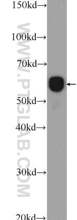 CCT3 Antibody in Western Blot (WB)