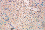 RPN2 Antibody in Immunohistochemistry (Paraffin) (IHC (P))