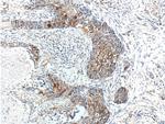 RPN2 Antibody in Immunohistochemistry (Paraffin) (IHC (P))