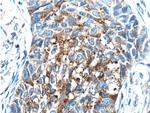 RPN2 Antibody in Immunohistochemistry (Paraffin) (IHC (P))
