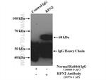 RPN2 Antibody in Immunoprecipitation (IP)
