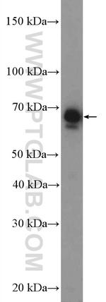 RPN2 Antibody in Western Blot (WB)