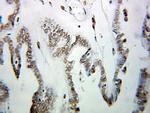 HNRNPUL1 Antibody in Immunohistochemistry (Paraffin) (IHC (P))