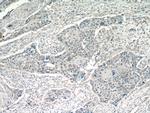 POT1 Antibody in Immunohistochemistry (Paraffin) (IHC (P))