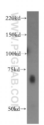IA-2/PTPRN Antibody in Western Blot (WB)