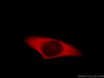 INVS Antibody in Immunocytochemistry (ICC/IF)