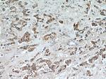 INVS Antibody in Immunohistochemistry (Paraffin) (IHC (P))