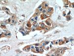 INVS Antibody in Immunohistochemistry (Paraffin) (IHC (P))