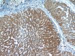 INVS Antibody in Immunohistochemistry (Paraffin) (IHC (P))