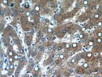 INVS Antibody in Immunohistochemistry (Paraffin) (IHC (P))