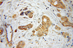 INVS Antibody in Immunohistochemistry (Paraffin) (IHC (P))
