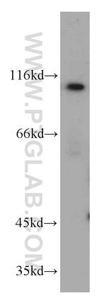 INVS Antibody in Western Blot (WB)