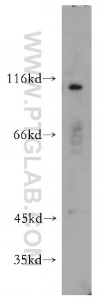INVS Antibody in Western Blot (WB)